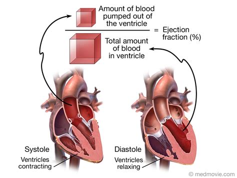 Ejection Fraction: What It Is, Types and Normal Range.